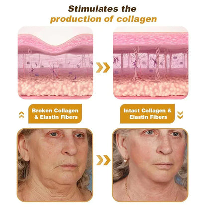Botox Bee Venom Wrinkle Repair Cream
